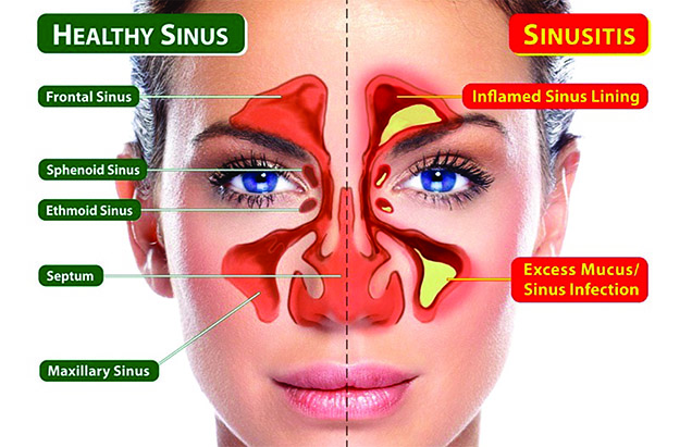 Smart Ways to Heal a Bitten Tongue Faster: 5 Effective Solutions for Quick Relief in 2025